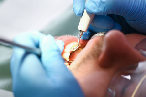 Best Dentist for Tooth Abscess  in Gordon Heights, NY