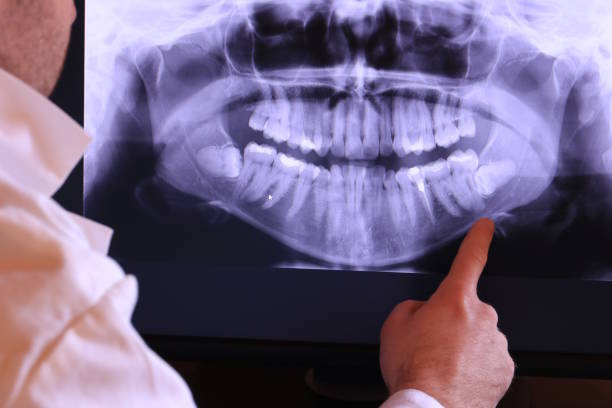 Best Chipped Tooth Repair Near Me  in Gordon Heights, NY